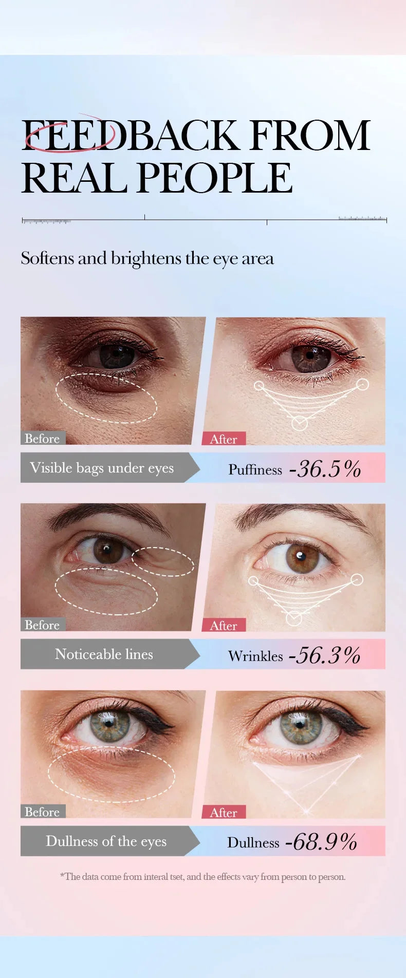 Women Instant Eye Bag Removal Cream with Collagen Anti-Wrinkle
