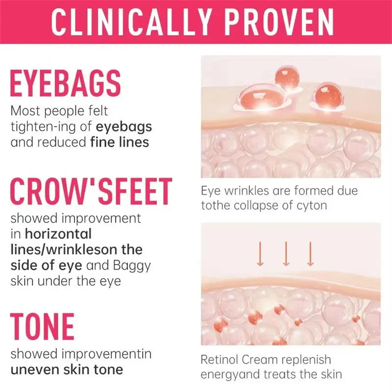 Women Instant Eye Bag Removal Cream with Collagen Anti-Wrinkle