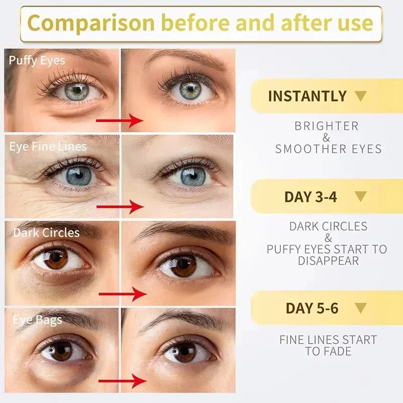 Women Instant Eye Bag Removal Cream with Collagen Anti-Wrinkle