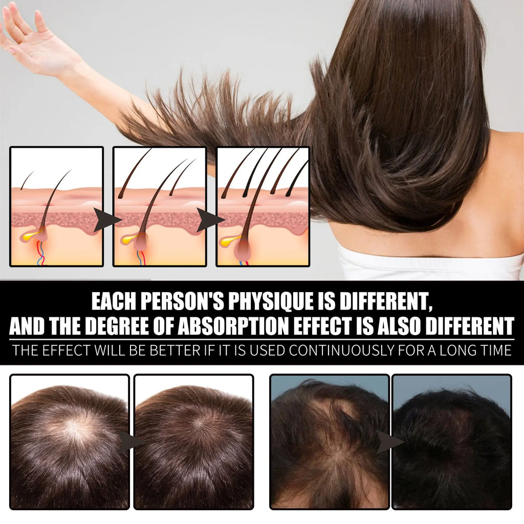 Huile essentielle de soin capillaire à la vitamine B7 et au collagène Nourrit le cuir chevelu Prévient la chute des cheveux Stabilise les racines des cheveux Protège les follicules pileux