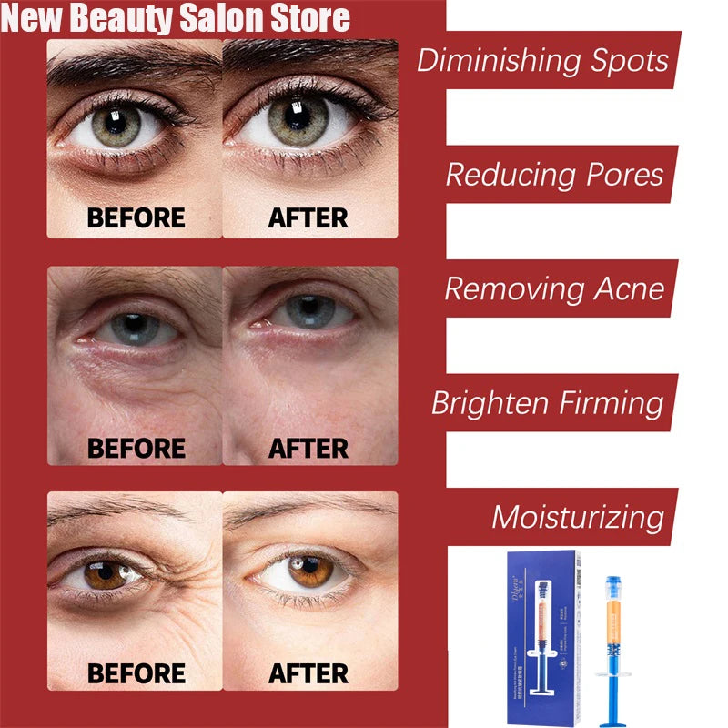 Anti Aging, Retinol Wrinkle Remover