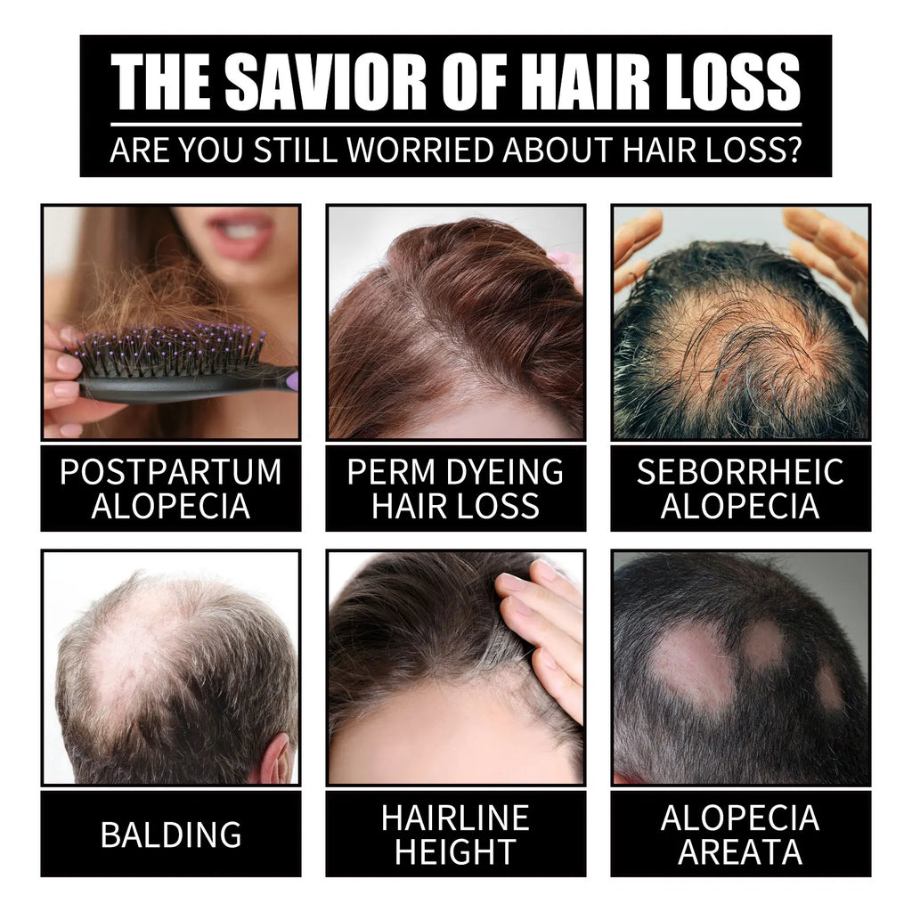 Huile essentielle de soin capillaire à la vitamine B7 et au collagène Nourrit le cuir chevelu Prévient la chute des cheveux Stabilise les racines des cheveux Protège les follicules pileux