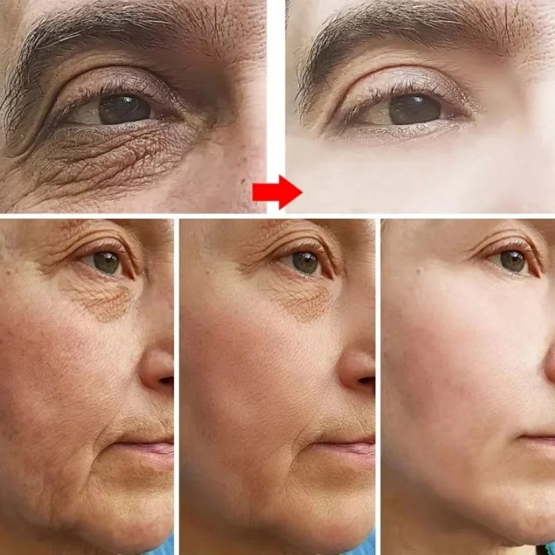 Anti Aging, Retinol Wrinkle Remover