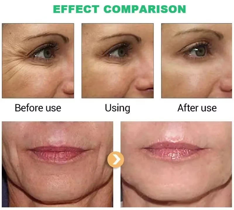 Anti Aging, Retinol Wrinkle Remover